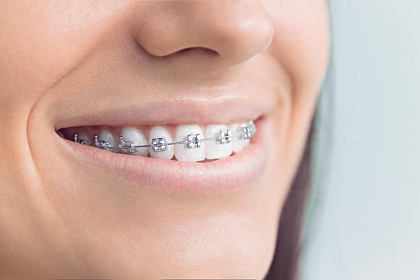 Laser Dentistry in Toppers, OK